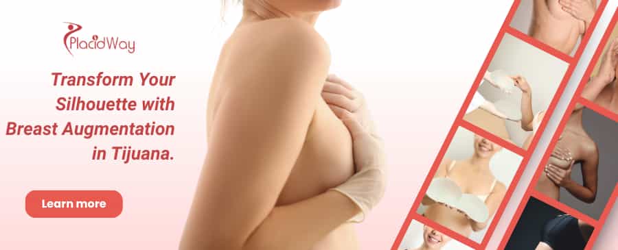 Breast Augmentation in Tijuana, Mexico thumbnail