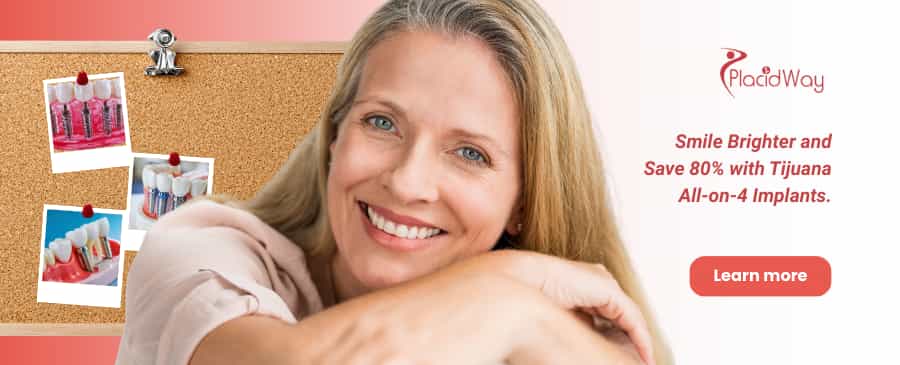 All on 4 Dental Implants in Tijuana, Mexico | Save 80% thumbnail