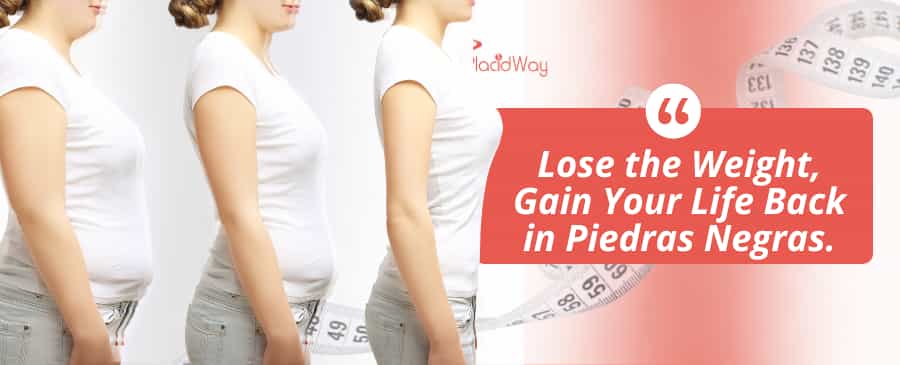 Gastric Sleeve Surgery in Piedras Negras, Mexico thumbnail