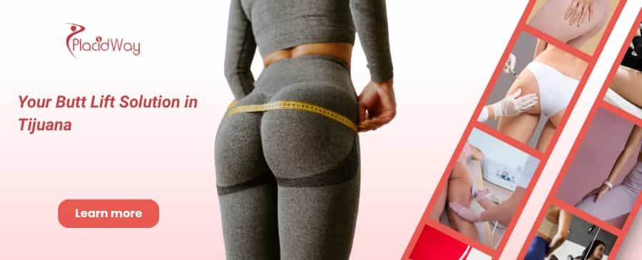 Brazilian Butt Lift in Tijuana, Mexico - Your Butt Lift Solution thumbnail