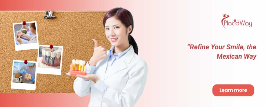 All on 8 Dental Implants in Tijuana - Affordable Dental Work in Mexico thumbnail