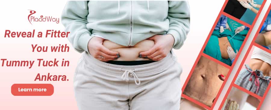 Tummy Tuck in Ankara, Turkey thumbnail