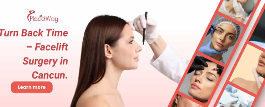 Facelift in Cancun, Mexico thumbnail