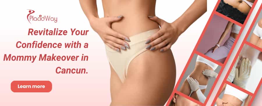 Mommy Makeover in Cancun, Mexico thumbnail