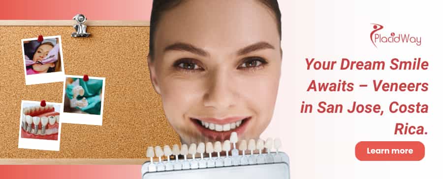 Dental Veneers in San Jose Costa Rica thumbnail