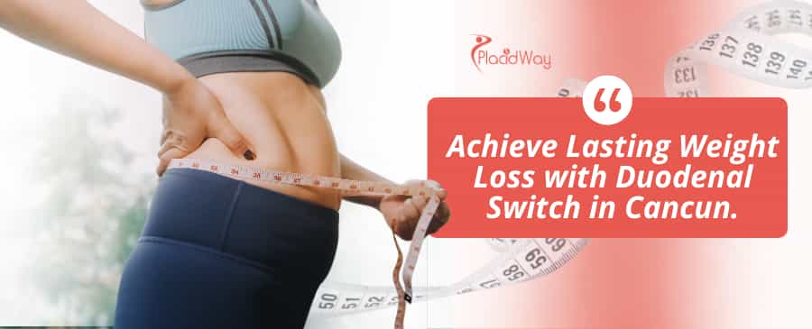 Duodenal Switch Surgery in Cancun, Mexico thumbnail