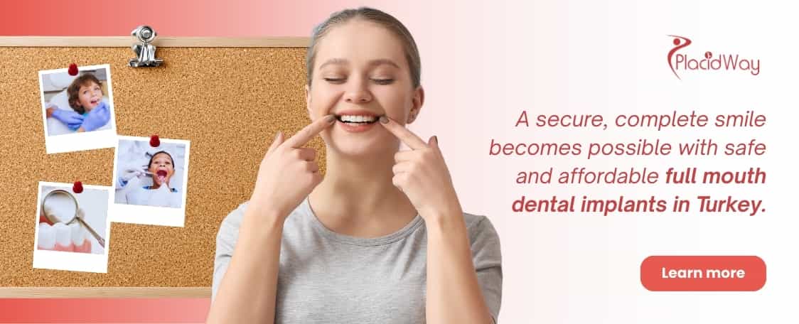 Full Mouth Dental Implants in Turkey - Affordable and Safe thumbnail