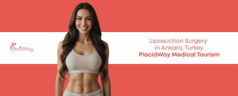 Liposuction in Ankara, Turkey thumbnail