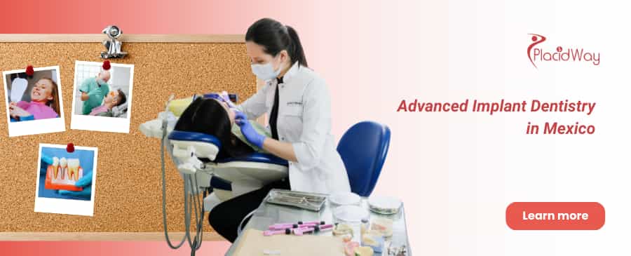 All on 6 Dental Implants in Cancun, Mexico thumbnail