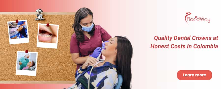 Dental Crowns in Bogota Colombia thumbnail