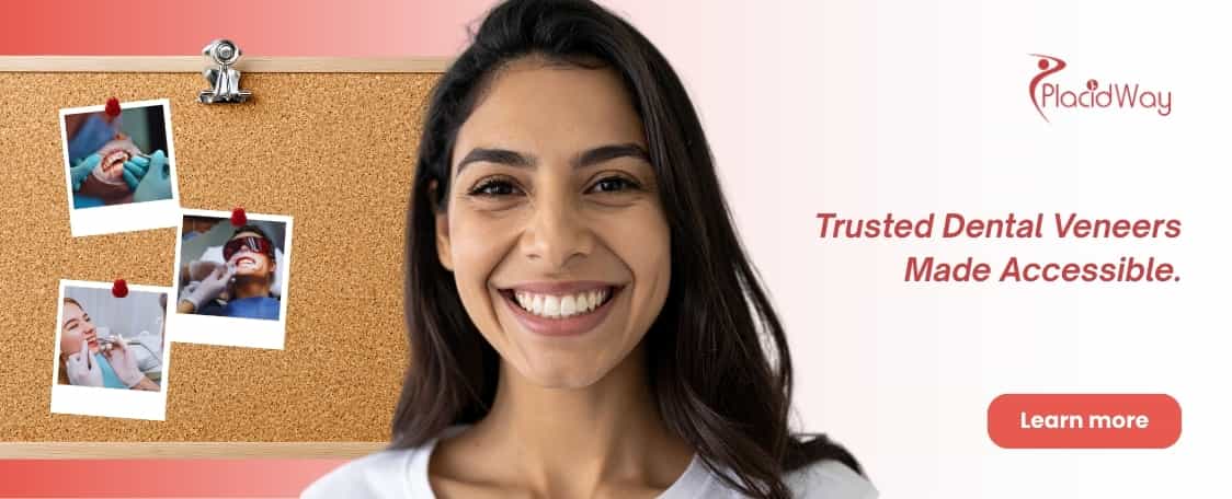 Koop goedkope en veilige facings in Colombia thumbnail