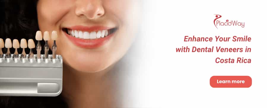 Dental Veneers in Costa Rica thumbnail