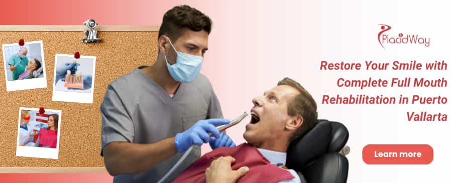 Full Mouth Restoration in Puerto Vallarta, Mexico thumbnail