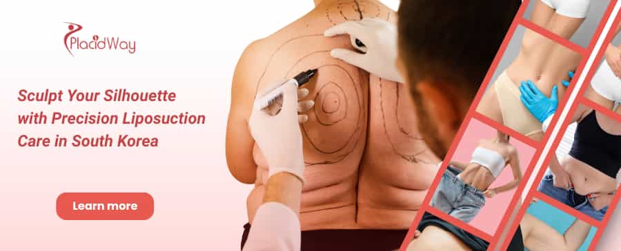 Liposuction in South Korea thumbnail