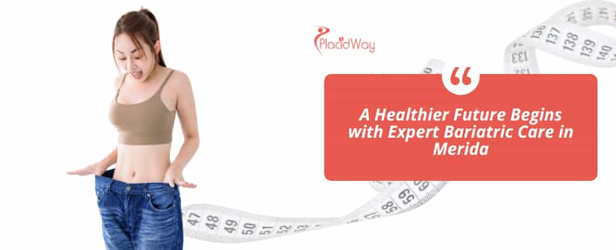 Bariatric Surgery in Merida, Mexico thumbnail