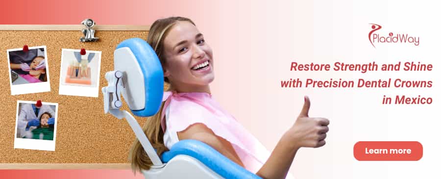 Dental Crowns in Puerto Vallarta, Mexico thumbnail