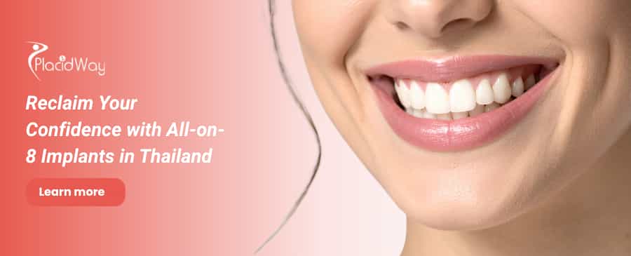 All on 8 Dental Implants in Thailand - Get Dental Implants Abroad  thumbnail
