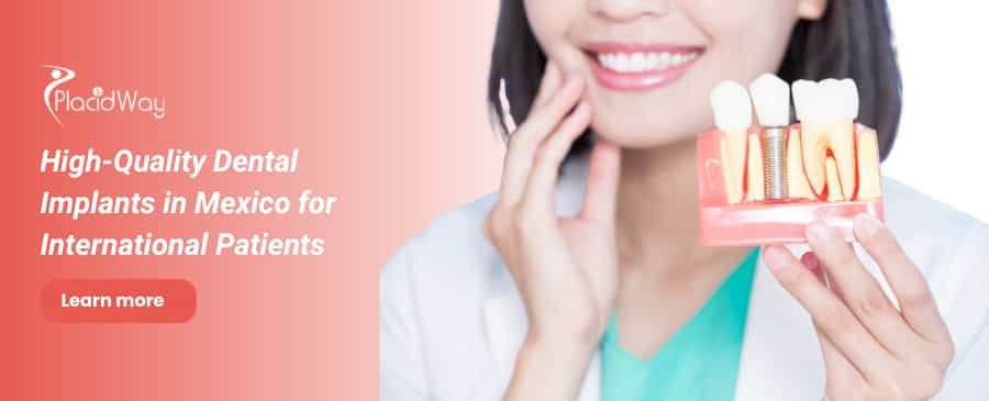 Dental Implants in Mexico thumbnail
