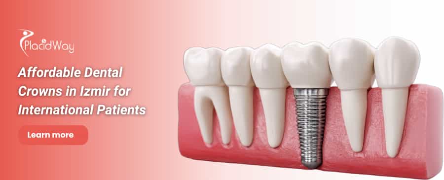 Dental Crowns in Izmir, Turkey thumbnail