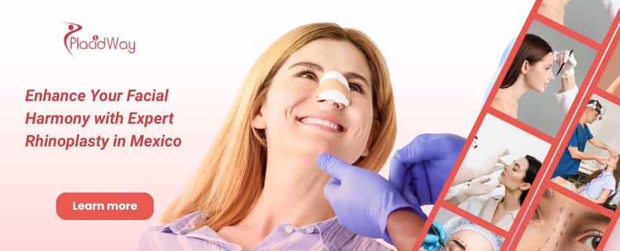 Rhinoplasty in Merida, Mexico thumbnail