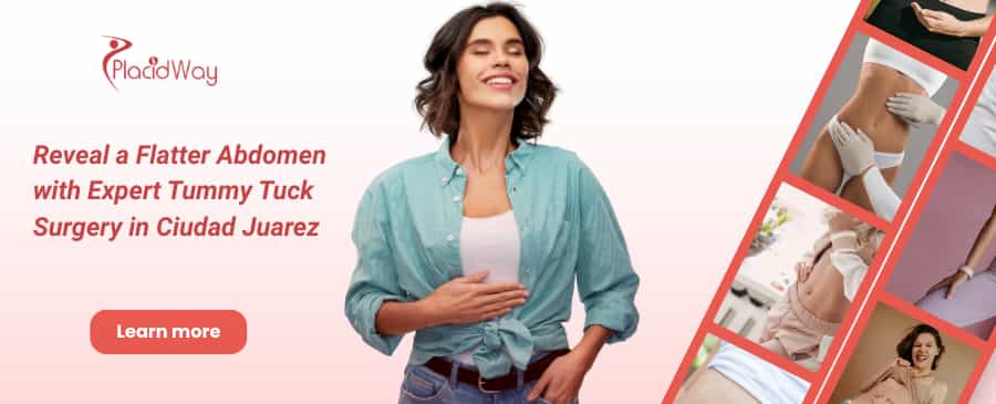 Tummy Tuck in Ciudad Juarez, Mexico thumbnail