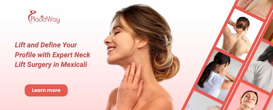 Neck Lift in Mexicali, Mexico thumbnail