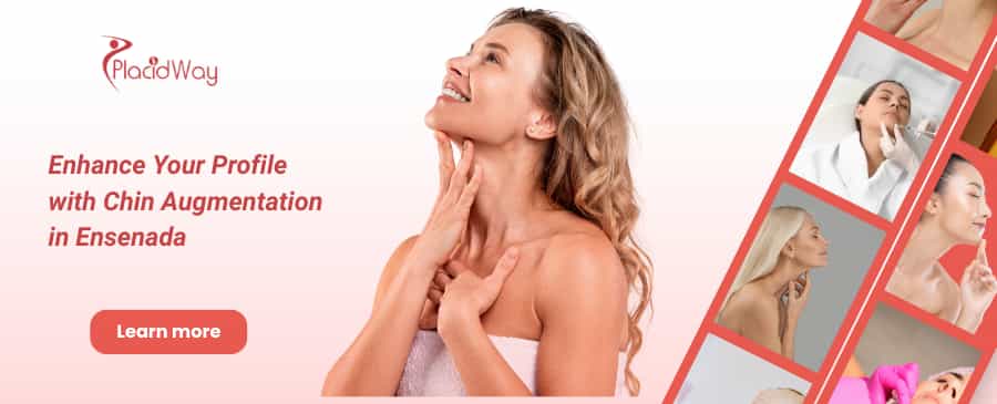 Chin Augmentation in Ensenada, Mexico thumbnail