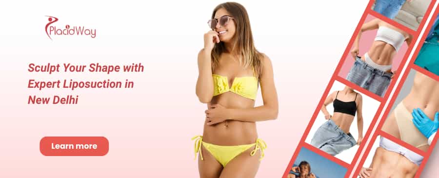 Liposuction in New Delhi, India thumbnail