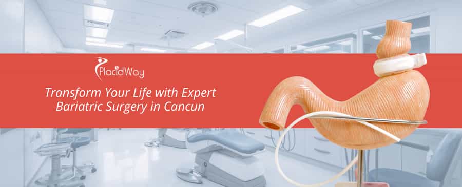 Bariatric Surgery in Cancun, Mexico - The Ultimate Guide thumbnail