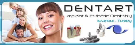 Dentart Banner Dental Implants In Turkey Istanbul