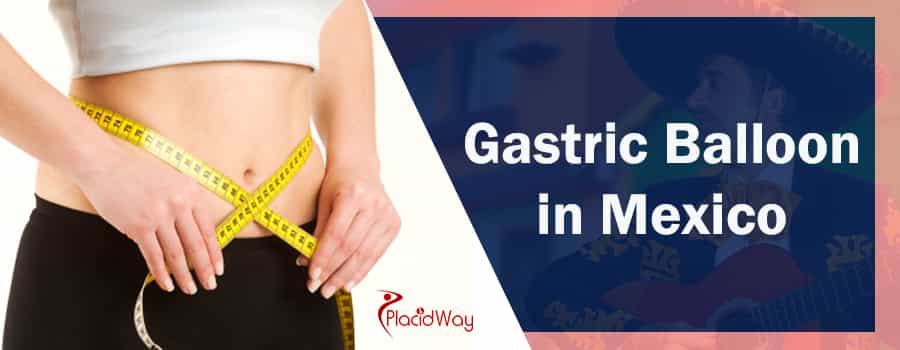 Gastric Balloon in Mexico Gastric Balloon in Mexico - Cost & Clinics