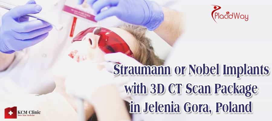 Straumann Or Nobel Implants With D Ct Scan Package