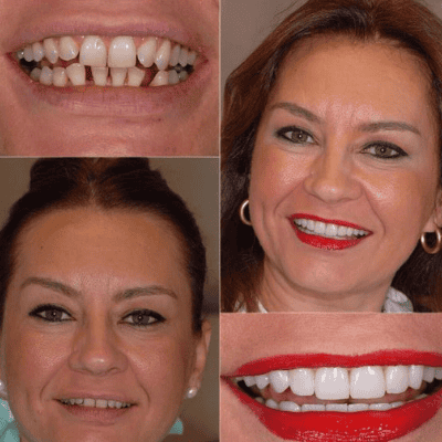 Bergedent Clinic in Istanbul, Turkey Reviews Bergedent Clinic in Istanbul, Turkey Review Picture