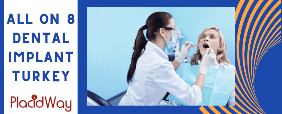 All On Dental Implant Turkey