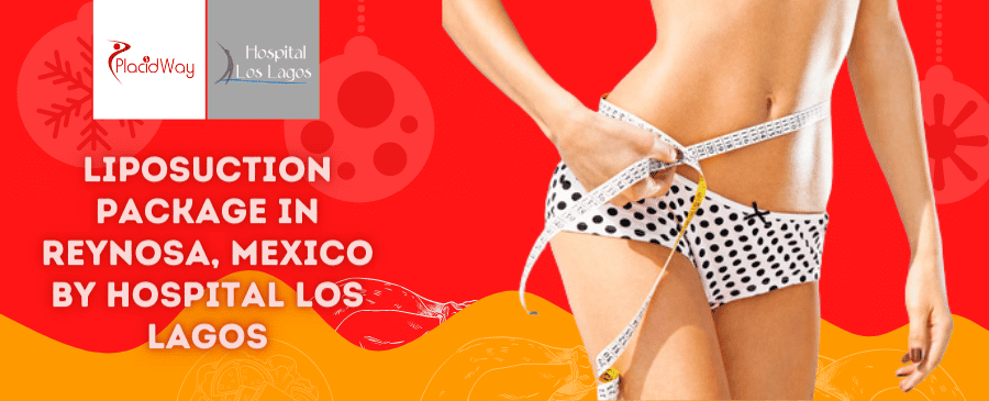 Package for Liposuction in Reynosa, Mexico by Hospital Los Lagos Package for Liposuction in Reynosa, Mexico by Hospital Los Lagos - reynosa liposuction cost