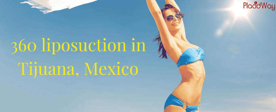 Liposuction In Tijuana, Mexico