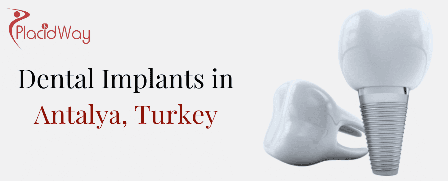 Dental Implants In Antalya, Turkey