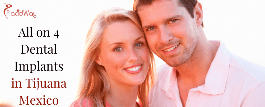 All On Dental Implants In Tijuana Mexico