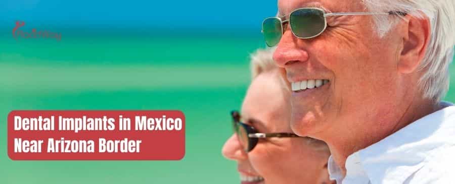 Implantes dentales en México cerca de la frontera con Arizona Dental Implants in Mexico Near Arizona Border