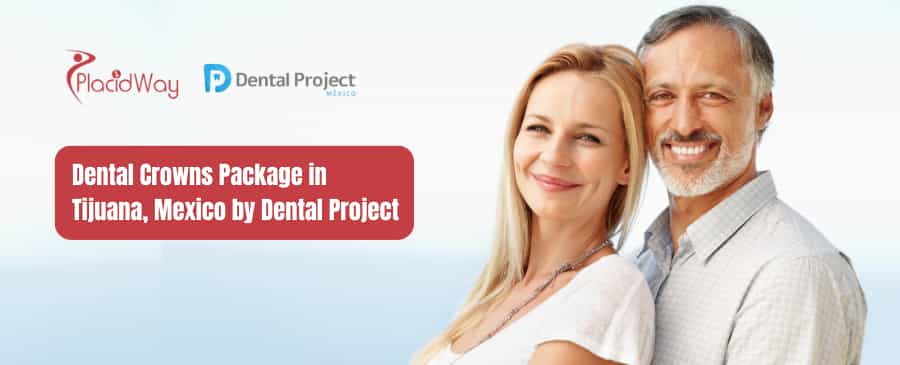 Paquete de coronas dentales en Tijuana, México por Dental Project