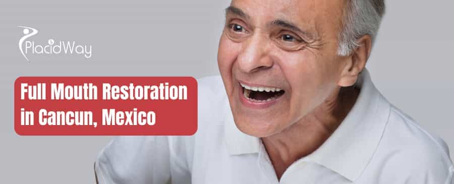 Full Mouth Restoration In Cancun, Mexico