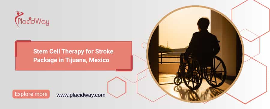 Stem Cell Therapy For Stroke Package In Tijuana, Mexico