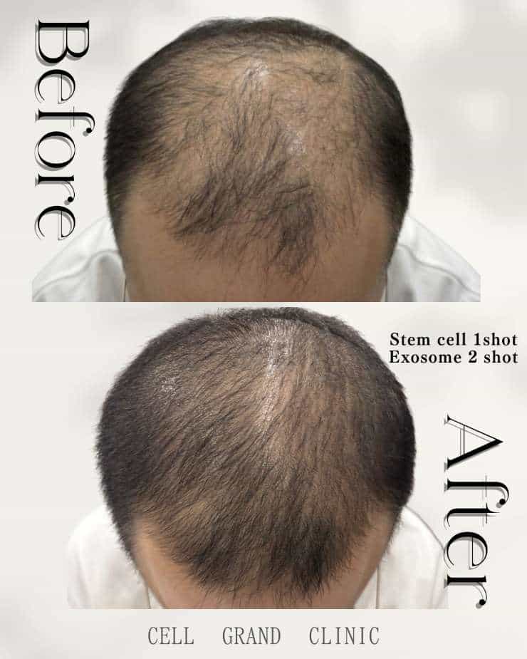 AGA Cases - Before-and-After Images