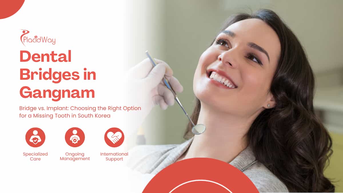 Dental Bridges in Gangnam