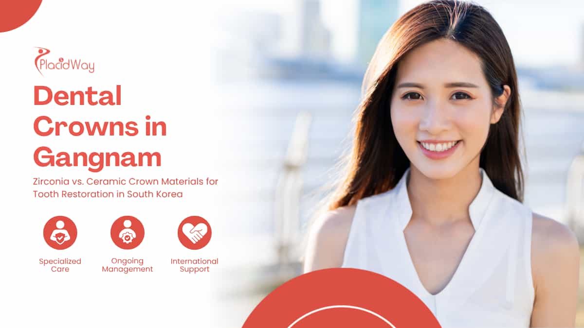 Dental Crowns in Gangnam