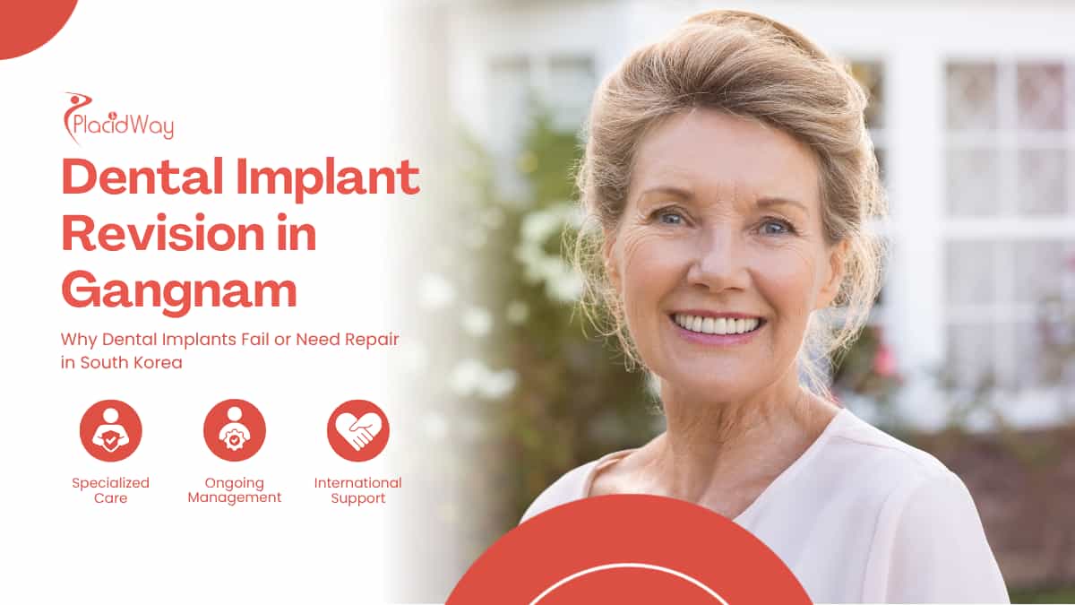 Dental Implant Revision in Gangnam