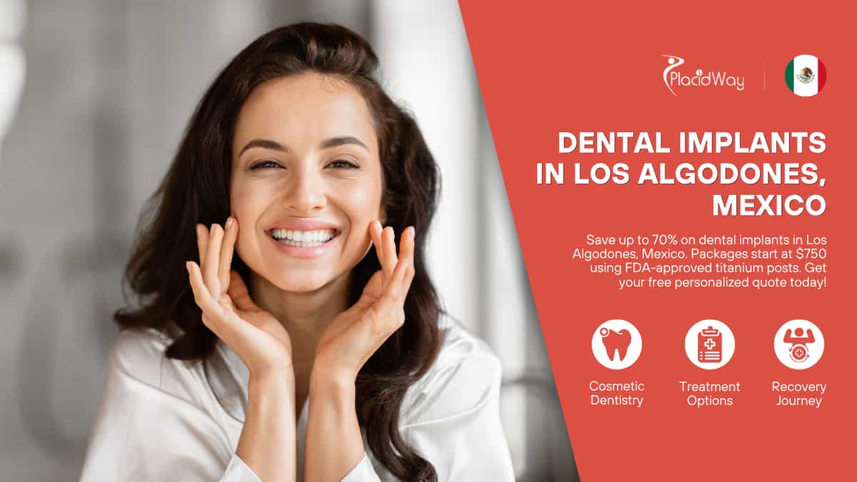 Dental Implants in Los Algodones, Mexico
