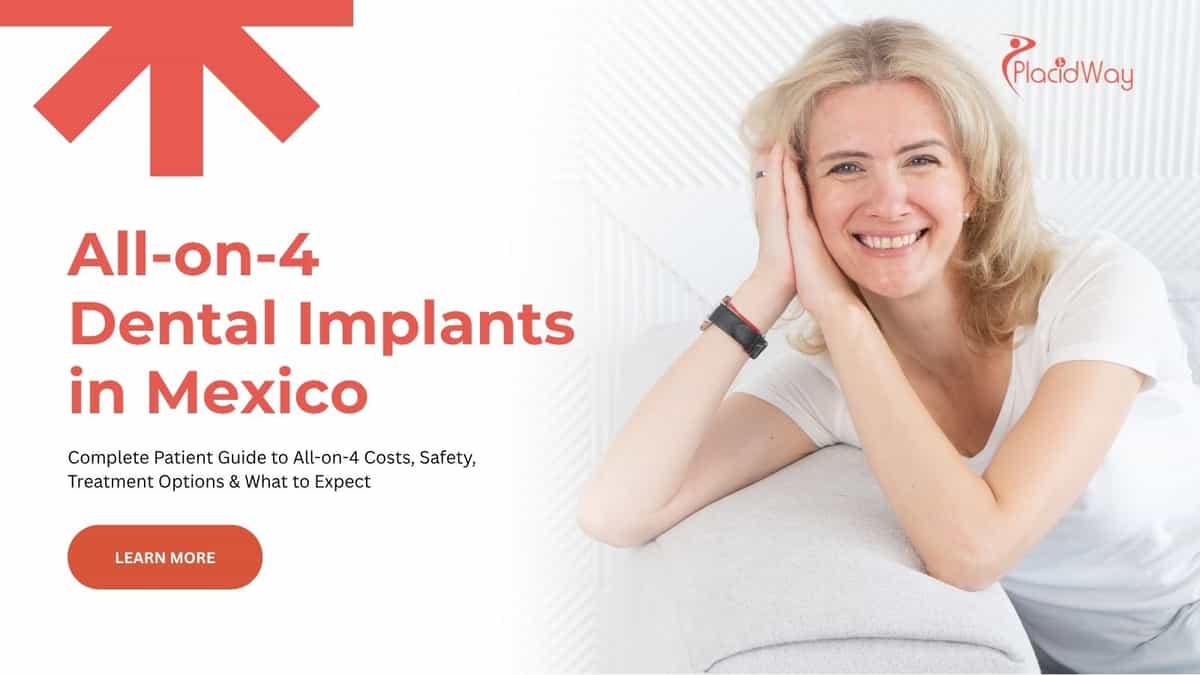 All-on-4 dental implants in Mexico