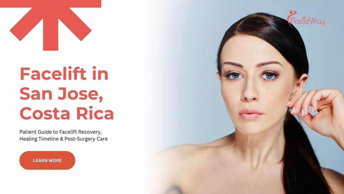 Facelift surgery in San Jose, Costa Rica