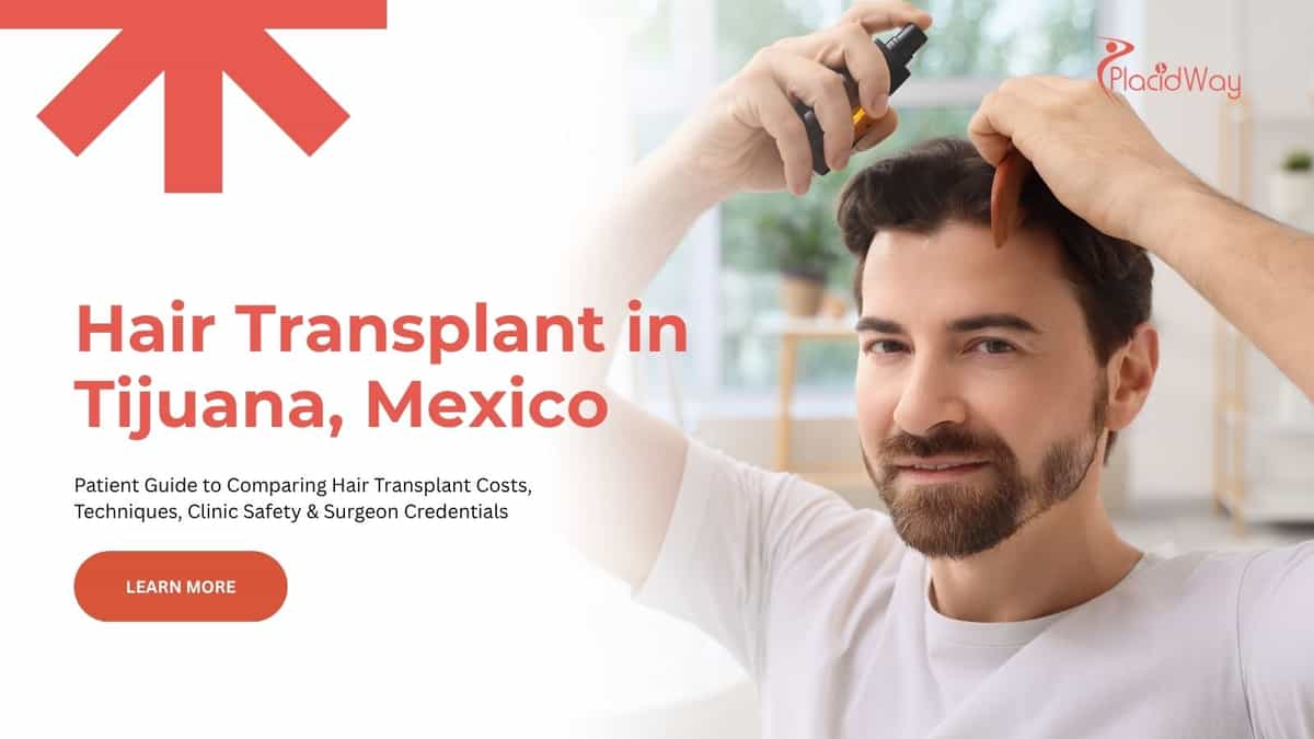 Hair transplant in Tijuana, Mexico